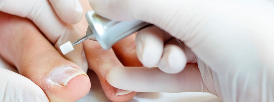 Behandeling van een schimmelnagel met de pedicuremotor