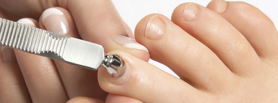 Pedicurebehandeling waarbij nagelriemen worden verzorgd